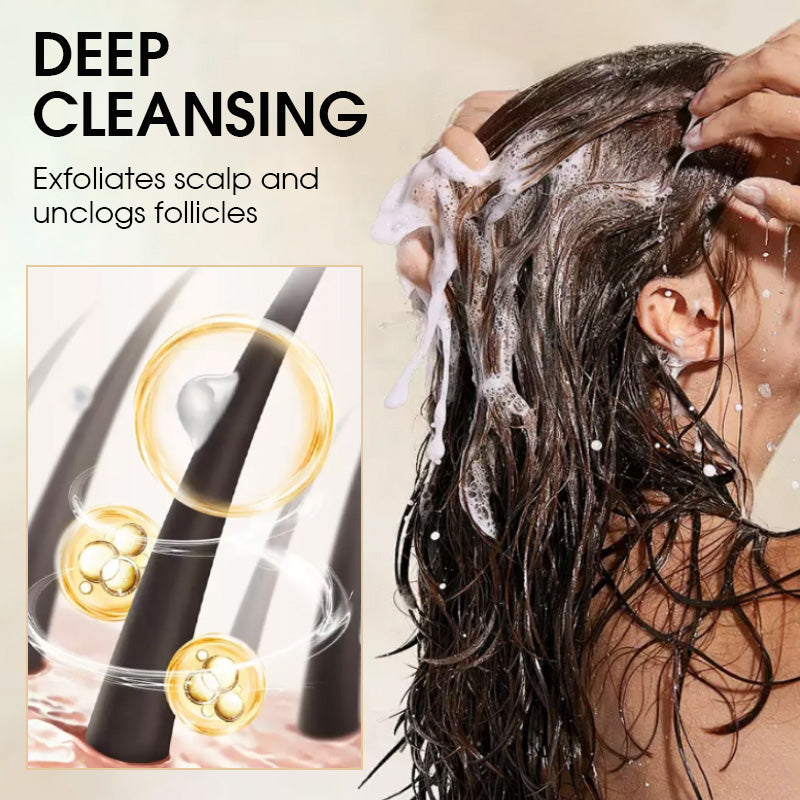 Anti-Dandruff Oil Control Shampoo