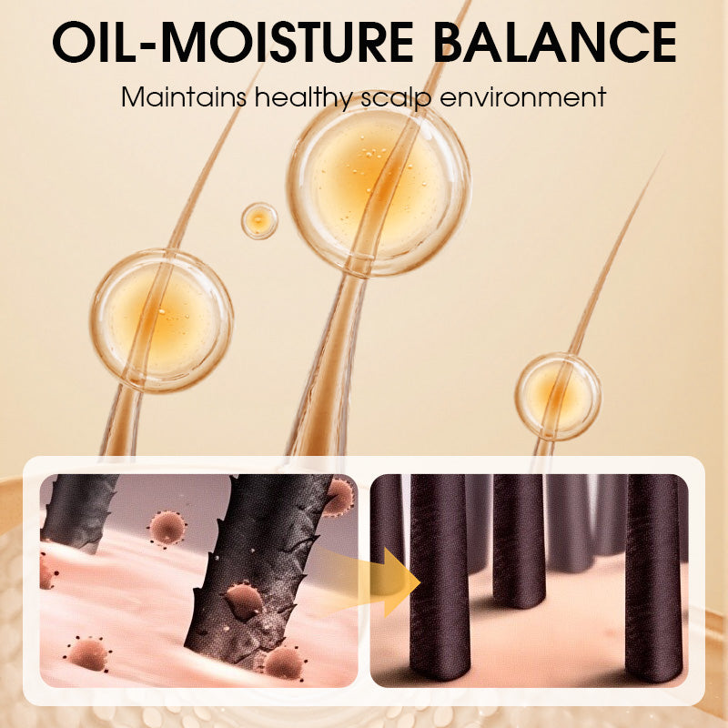 Anti-Dandruff Oil Control Shampoo