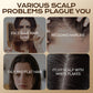 Herbal Hair Loss Prevention and Hair Growth Shampoo