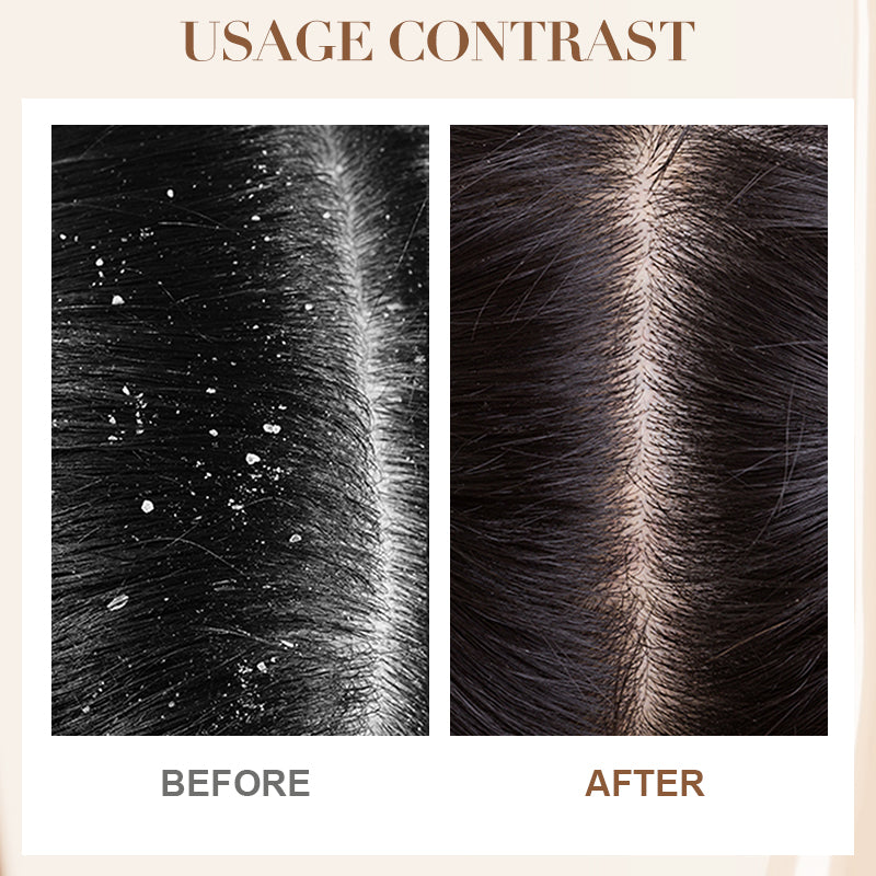 Dandruff Control & Soothing Shampoo