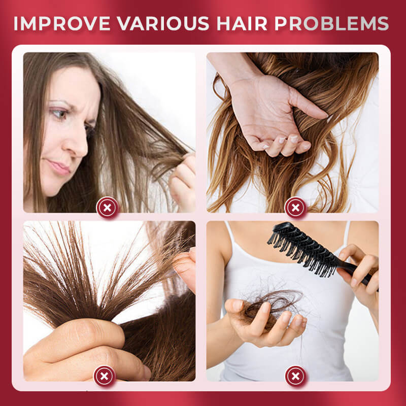 ✨Magic Hair Care (BUY 2 GET 10% OFF )