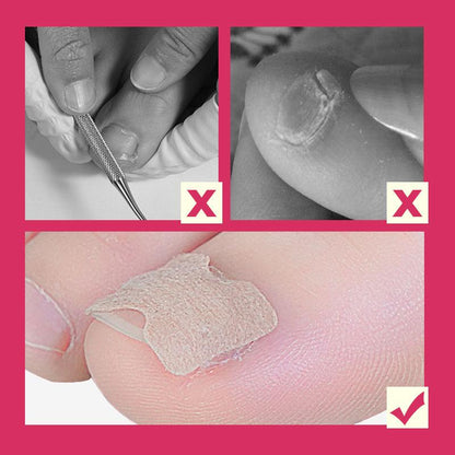 Fast Healing Toenail Patch (10pcs)