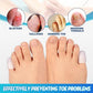 SUMMER HOT SALE-  Little Toe Protectors