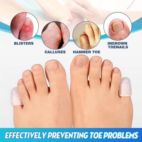 SUMMER HOT SALE-  Little Toe Protectors