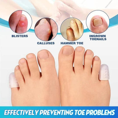 SUMMER HOT SALE-  Little Toe Protectors