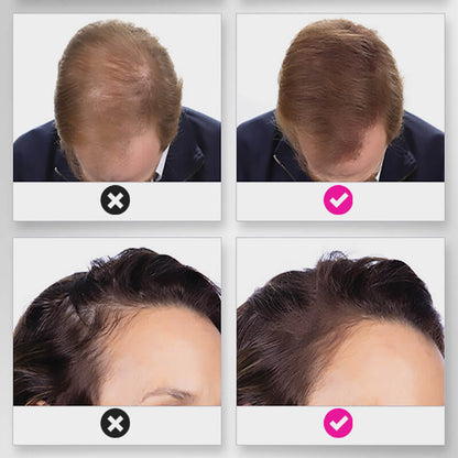 🔥Limited time 50% off sale🔥Hair Thickening Hair Building Fiber Powder