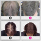 🔥Limited time 50% off sale🔥Hair Thickening Hair Building Fiber Powder