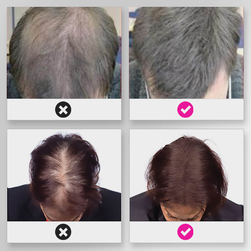 🔥Limited time 50% off sale🔥Hair Thickening Hair Building Fiber Powder
